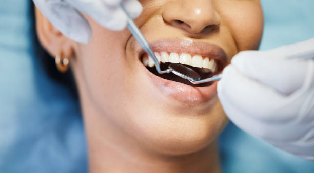Best Same-Day Emergency Dental Services in Dock Junction, GA