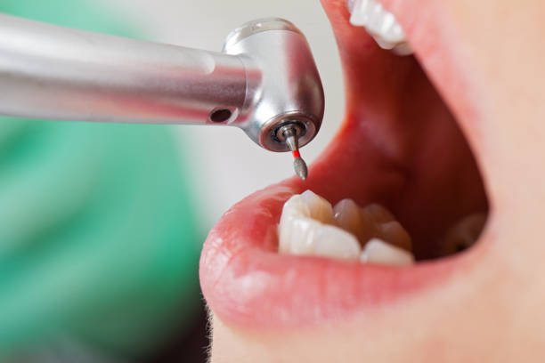 Best Emergency Denture Repair in Dock Junction, GA